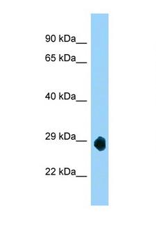 SMCO3 Antibody - LOC632209 antibody Western blot of Mouse Brain lysate. Antibody concentration 1 ug/ml.  This image was taken for the unconjugated form of this product. Other forms have not been tested.