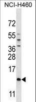 SMCP Antibody - SMCP Antibody western blot of NCI-H460 cell line lysates (35 ug/lane). The SMCP antibody detected the SMCP protein (arrow).