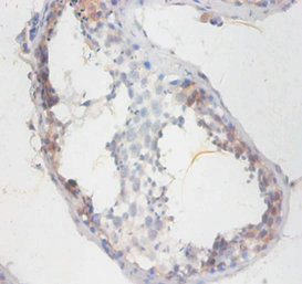 SMCP Antibody - Immunohistochemistry of paraffin-embedded human testis tissue using SMCP Antibody at dilution of 1:100