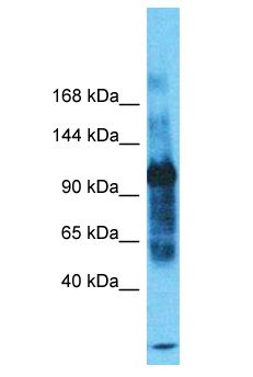 SMCR8 Antibody - SMCR8 antibody Western Blot of THP-1. Antibody dilution: 1 ug/ml.  This image was taken for the unconjugated form of this product. Other forms have not been tested.