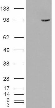 SMEK1 Antibody - HEK293 overexpressing SMEK1 (RC221040) and probed with (mock transfection in first lane).