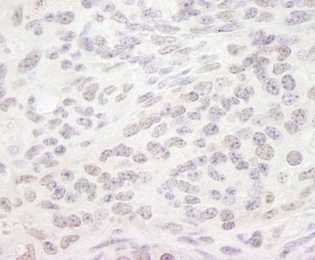 SMEK1 Antibody - Detection of Mouse PPP4R3 Alpha by Immunohistochemistry. Sample: FFPE section of mouse teratoma. Antibody: Affinity purified rabbit anti-PPP4R3 Alpha used at a dilution of 1:250. Epitope Retrieval Buffer-High pH (IHC-101J) was substituted for Epitope Retrieval Buffer-Reduced pH.