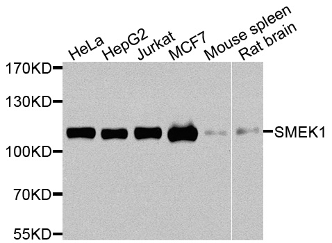 SMEK1 Antibody - Western blot analysis of extracts of various cells.
