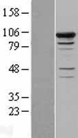 SMEK1 Protein - Western validation with an anti-DDK antibody * L: Control HEK293 lysate R: Over-expression lysate