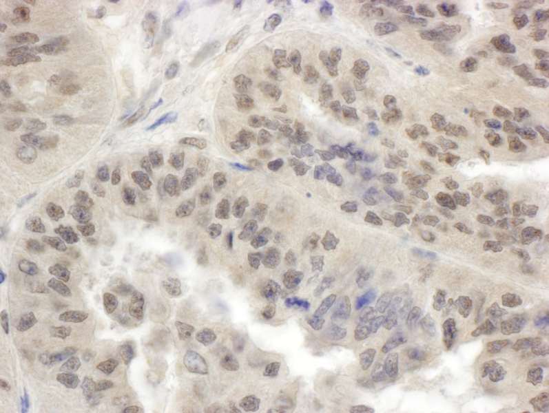 Anti-SMG1 / ATX Antibody | Rabbit anti-Human Polyclonal IP,WB | LSBio