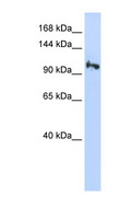 SMG5 Antibody - SMG5 antibody Western blot of Jurkat lysate. This image was taken for the unconjugated form of this product. Other forms have not been tested.