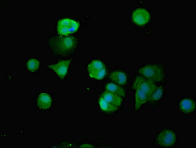 SMG6 Antibody - Immunofluorescent analysis of MCF-7 cells using SMG6 Antibody at dilution of 1:100 and Alexa Fluor 488-congugated AffiniPure Goat Anti-Rabbit IgG(H+L)