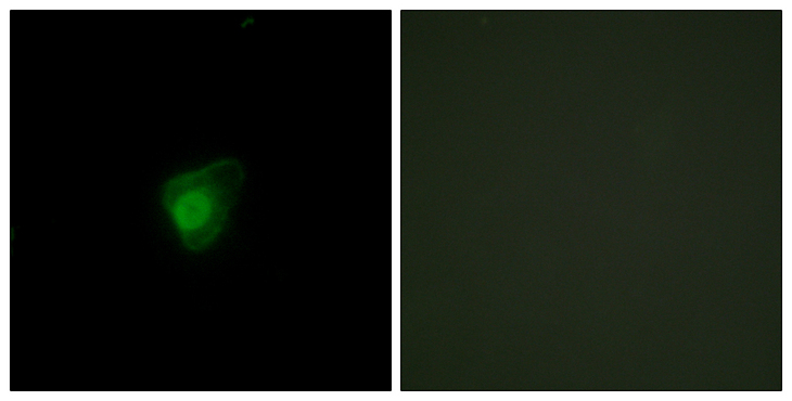 SMG7 Antibody - Immunofluorescence analysis of HepG2 cells, using SMG7 Antibody. The picture on the right is blocked with the synthesized peptide.