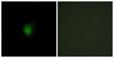 SMG7 Antibody - Immunofluorescence analysis of HepG2 cells, using SMG7 Antibody. The picture on the right is blocked with the synthesized peptide.