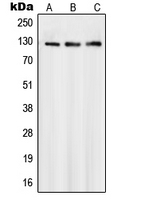 SMG7 Antibody - Western blot analysis of SMG7 expression in Jurkat (A); A431 (B); HeLa (C) whole cell lysates.