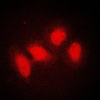 SMG7 Antibody - Immunofluorescent analysis of SMG7 staining in A431 cells. Formalin-fixed cells were permeabilized with 0.1% Triton X-100 in TBS for 5-10 minutes and blocked with 3% BSA-PBS for 30 minutes at room temperature. Cells were probed with the primary antibody in 3% BSA-PBS and incubated overnight at 4 C in a humidified chamber. Cells were washed with PBST and incubated with a DyLight 594-conjugated secondary antibody (red) in PBS at room temperature in the dark. DAPI was used to stain the cell nuclei (blue).