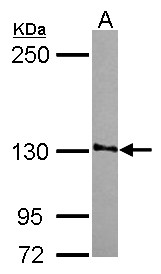 SMG7 Antibody - Sample (30 ug of whole cell lysate) A: NT2D1 5% SDS PAGE SMG7 antibody diluted at 1:1000