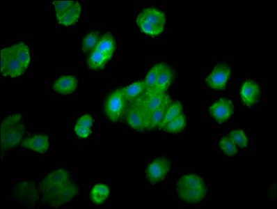 SMG7 Antibody - Immunofluorescence staining of HepG2 cells diluted at 1:200, counter-stained with DAPI. The cells were fixed in 4% formaldehyde, permeabilized using 0.2% Triton X-100 and blocked in 10% normal Goat Serum. The cells were then incubated with the antibody overnight at 4°C.The Secondary antibody was Alexa Fluor 488-congugated AffiniPure Goat Anti-Rabbit IgG (H+L).