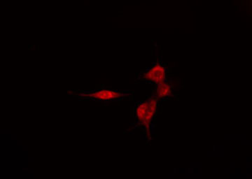 SMG7 Antibody - Staining HeLa cells by IF/ICC. The samples were fixed with PFA and permeabilized in 0.1% Triton X-100, then blocked in 10% serum for 45 min at 25°C. The primary antibody was diluted at 1:200 and incubated with the sample for 1 hour at 37°C. An Alexa Fluor 594 conjugated goat anti-rabbit IgG (H+L) antibody, diluted at 1/600, was used as secondary antibody.