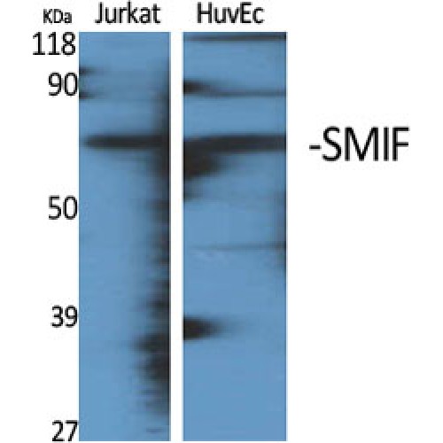 SMIF / DCP1A Antibody - Western blot of SMIF antibody
