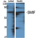 SMIF / DCP1A Antibody - Western blot of SMIF antibody