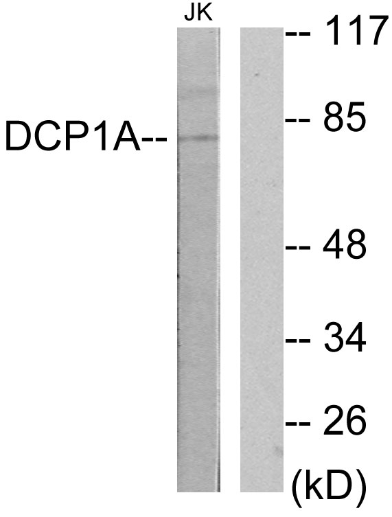 SMIF / DCP1A Antibody - Western blot analysis of lysates from Jurkat cells, using DCP1A Antibody. The lane on the right is blocked with the synthesized peptide.