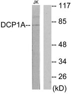 SMIF / DCP1A Antibody - Western blot analysis of lysates from Jurkat cells, using DCP1A Antibody. The lane on the right is blocked with the synthesized peptide.