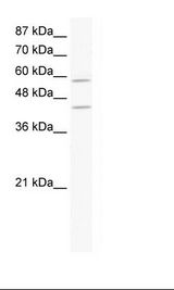 SMIF / DCP1A Antibody - Jurkat Cell Lysate.  This image was taken for the unconjugated form of this product. Other forms have not been tested.