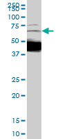 SMIF / DCP1A Antibody - DCP1A monoclonal antibody (M01), clone 2D12. Western blot of DCP1A expression in IMR-32.