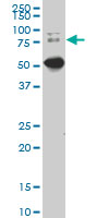 SMIF / DCP1A Antibody - DCP1A monoclonal antibody (M02), clone 2F11. Western blot of DCP1A expression in IMR-32.