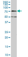SMIF / DCP1A Antibody - DCP1A monoclonal antibody (M07), clone 2G10. Western blot of DCP1A expression in IMR-32.