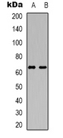 SMIF / DCP1A Antibody - Western blot analysis of DCP1A expression in HUVEC (A); Jurkat (B) whole cell lysates.