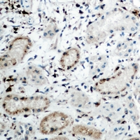 SMIF / DCP1A Antibody - Immunohistochemical analysis of DCP1A staining in human kidney formalin fixed paraffin embedded tissue section. The section was pre-treated using heat mediated antigen retrieval with sodium citrate buffer (pH 6.0). The section was then incubated with the antibody at room temperature and detected using an HRP polymer system. DAB was used as the chromogen. The section was then counterstained with hematoxylin and mounted with DPX.