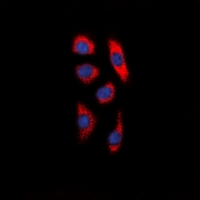 SMIF / DCP1A Antibody - Immunofluorescent analysis of DCP1A staining in HepG2 cells. Formalin-fixed cells were permeabilized with 0.1% Triton X-100 in TBS for 5-10 minutes and blocked with 3% BSA-PBS for 30 minutes at room temperature. Cells were probed with the primary antibody in 3% BSA-PBS and incubated overnight at 4 deg C in a humidified chamber. Cells were washed with PBST and incubated with a DyLight 594-conjugated secondary antibody (red) in PBS at room temperature in the dark. DAPI was used to stain the cell nuclei (blue).