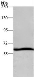 SMIF / DCP1A Antibody - Western blot analysis of HeLa cell, using DCP1A Polyclonal Antibody at dilution of 1:1100.