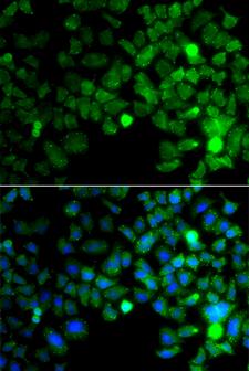 SMIF / DCP1A Antibody - Immunofluorescence analysis of A549 cells.