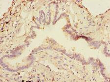 SMIF / DCP1A Antibody - Immunohistochemistry of paraffin-embedded human lung tissue at dilution 1:100