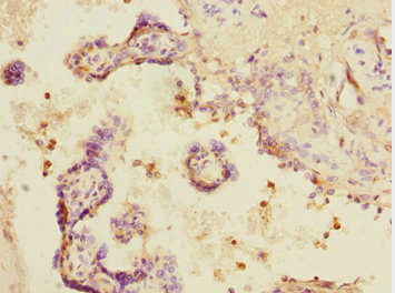 SMIF / DCP1A Antibody - Immunohistochemistry of paraffin-embedded human placenta tissue at dilution 1:100