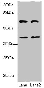 SMIF / DCP1A Antibody - Western blot All Lanes: DCP1A antibody at 3.79ug/ml Lane 1: Jurkat whole cell lysate Lane 2: HepG-2 whole cell lysate Secondary Goat polyclonal to Rabbit IgG at 1/10000 dilution Predicted band size: 64,60 kDa Observed band size: 63 kDa,40 kDa