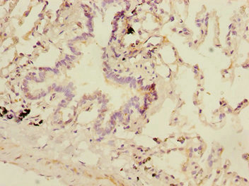 SMIF / DCP1A Antibody - Immunohistochemistry of paraffin-embedded human lung tissue at dilution 1:100