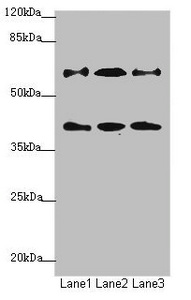 SMIF / DCP1A Antibody - Western blot All Lanes: DCP1A antibody at 1.23ug/ml Lane 1: Jurkat whole cell lysate Lane 2: 293T whole cell lysate Lane 3: HepG-2 whole cell lysate Secondary Goat polyclonal to Rabbit IgG at 1/10000 dilution Predicted band size: 64,60 kDa Observed band size: 63 kDa,40 kDa