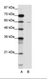 SMIF / DCP1A Antibody - A: Marker, B: Jurkat Cell Lysate.  This image was taken for the unconjugated form of this product. Other forms have not been tested.