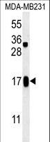 SMIM14 / C4orf34 Antibody - C4orf34 Antibody western blot of MDA-MB231 cell line lysates (35 ug/lane). The C4orf34 antibody detected the C4orf34 protein (arrow).