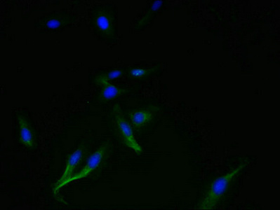 SMIM14 / C4orf34 Antibody - Immunofluorescent analysis of Hela cells using SMIM14 Antibody at dilution of 1:100 and Alexa Fluor 488-congugated AffiniPure Goat Anti-Rabbit IgG(H+L)