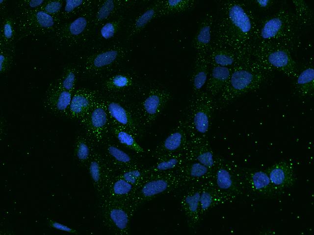 SMIM5 Antibody - Immunofluorescence staining of SMIM5 in U2OS cells. Cells were fixed with 4% PFA, permeabilzed with 0.1% Triton X-100 in PBS, blocked with 10% serum, and incubated with rabbit anti-Human SMIM5 polyclonal antibody (dilution ratio 1:100) at 4°C overnight. Then cells were stained with the Alexa Fluor 488-conjugated Goat Anti-rabbit IgG secondary antibody (green) and counterstained with DAPI (blue). Positive staining was localized to Cytoplasm.
