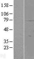 SMIM7 / C19orf42 Protein - Western validation with an anti-DDK antibody * L: Control HEK293 lysate R: Over-expression lysate