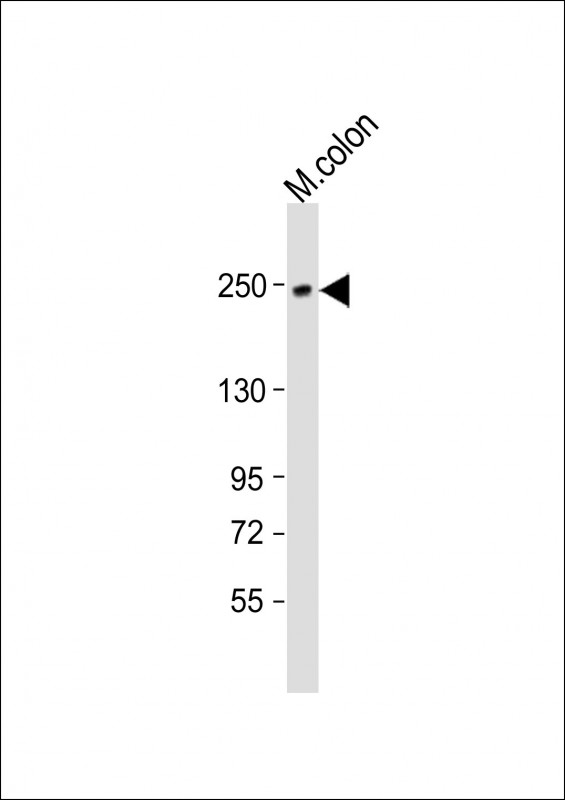 SMMHC / MYH11 Antibody - Anti-MYH11 Antibody (N-Term) at 1:2000 dilution + mouse colon lysate Lysates/proteins at 20 ug per lane. Secondary Goat Anti-Rabbit IgG, (H+L), Peroxidase conjugated at 1:10000 dilution. Predicted band size: 227 kDa. Blocking/Dilution buffer: 5% NFDM/TBST.