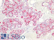 SMMHC / MYH11 Antibody - Human Breast: Formalin-Fixed, Paraffin-Embedded (FFPE)