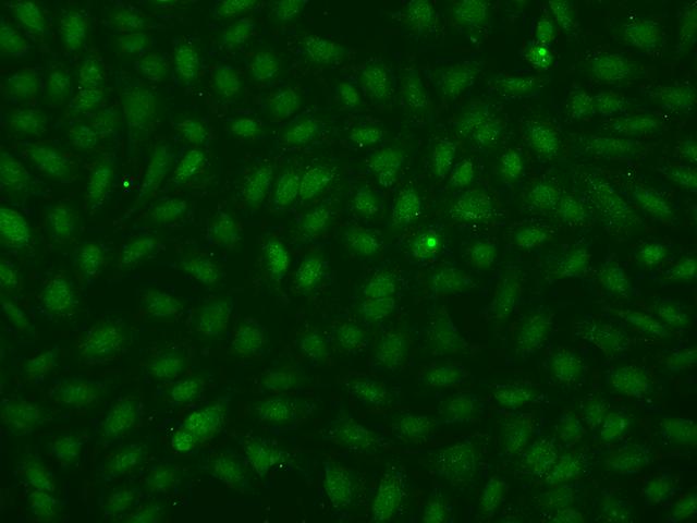SMMHC / MYH11 Antibody - Immunofluorescence staining of MYH11 in U2OS cells. Cells were fixed with 4% PFA, permeabilzed with 0.1% Triton X-100 in PBS, blocked with 10% serum, and incubated with rabbit anti-Human MYH11 polyclonal antibody (dilution ratio 1:200) at 4°C overnight. Then cells were stained with the Alexa Fluor 488-conjugated Goat Anti-rabbit IgG secondary antibody (green). Positive staining was localized to Nucleus.