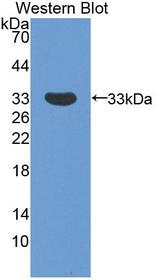 SMN1 Antibody - Western blot of SMN1 antibody.