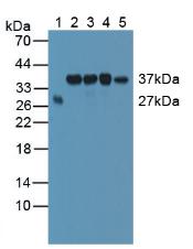 SMN1 Antibody - Western Blot; Sample: Lane1: Human Serum; Lane2: Human Hela Cells; Lane3: Human HepG2 Cells; Lane4: Human 293T Cells; Lane5: Mouse Testis Tissue.