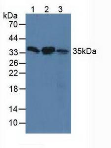 SMN1 Antibody - Western Blot; Sample: Lane1: Human Hela Cells; Lane2: Human 293T Cells; Lane3: Human hepG2 Cells.