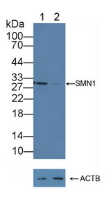 SMN1 Antibody - Knockout Varification: Lane 1: Wild-type Hela cell lysate; Lane 2: SMN1 knockout Hela cell lysate; Predicted MW: 31,30,28,27kd Observed MW: 30kd Primary Ab: 3µg/ml Rabbit Anti-Human SMN1 Antibody Second Ab: 0.2µg/mL HRP-Linked Caprine Anti-Rabbit IgG Polyclonal Antibody