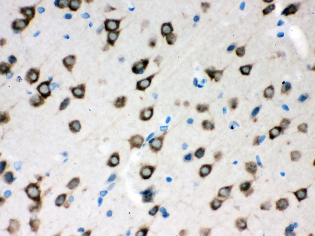 SMN1 Antibody - SMN1/2 antibody IHC-paraffin: Rat Brain Tissue.