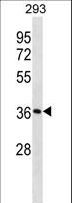 SMN1 Antibody - SMN1 Antibody western blot of 293 cell line lysates (35 ug/lane). The SMN1 antibody detected the SMN1 protein (arrow).